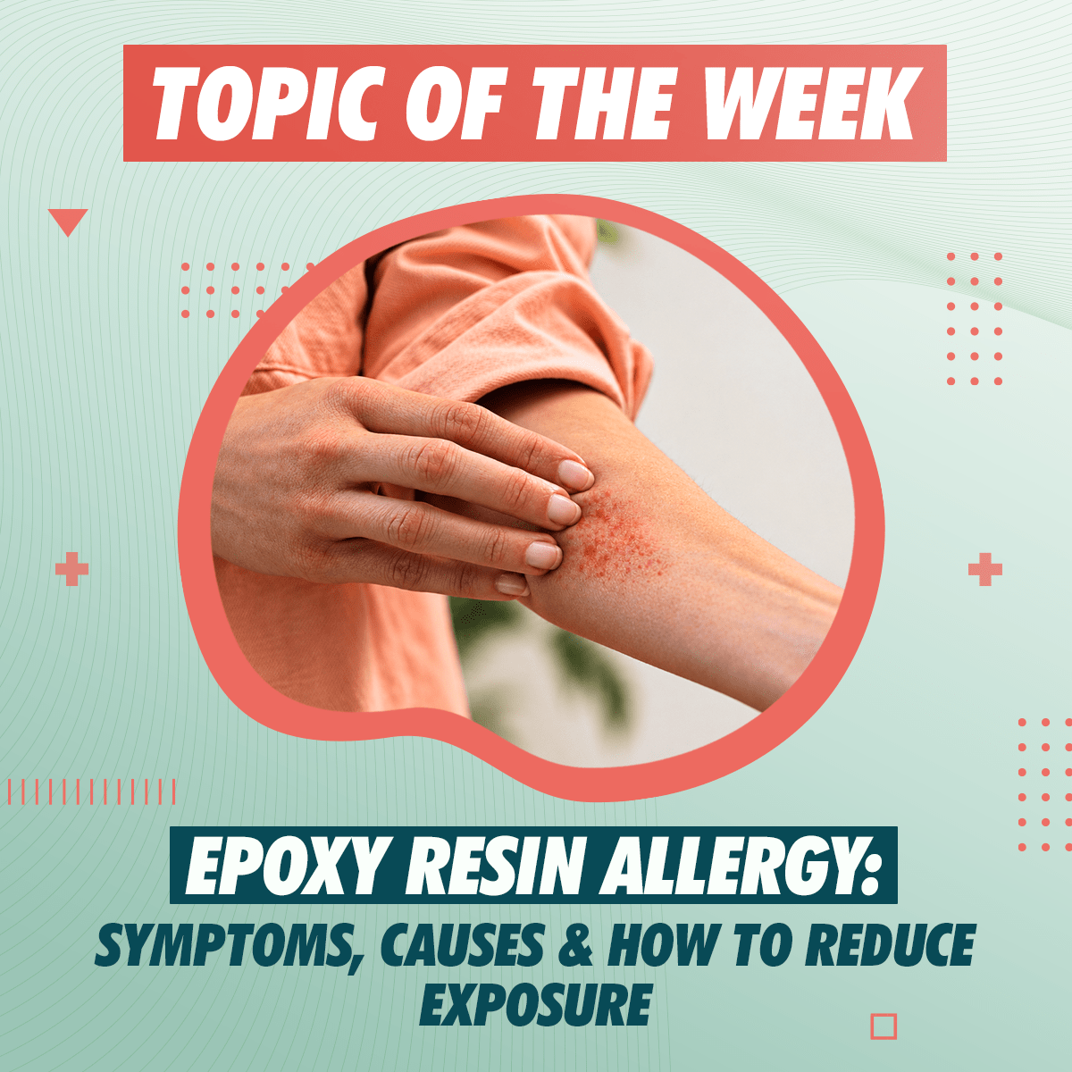 Can You Be Allergic to Epoxy Resin? - Craft Resin US